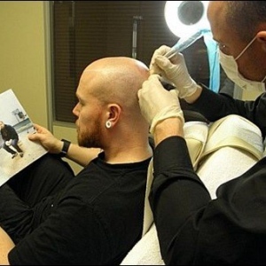 Benefits Of The Scalp Pigmentation