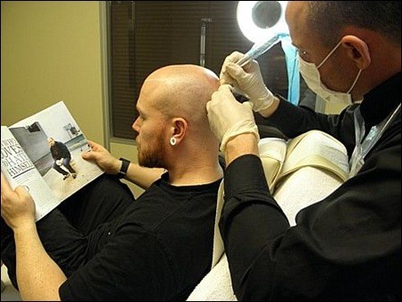 Benefits Of The Scalp Pigmentation